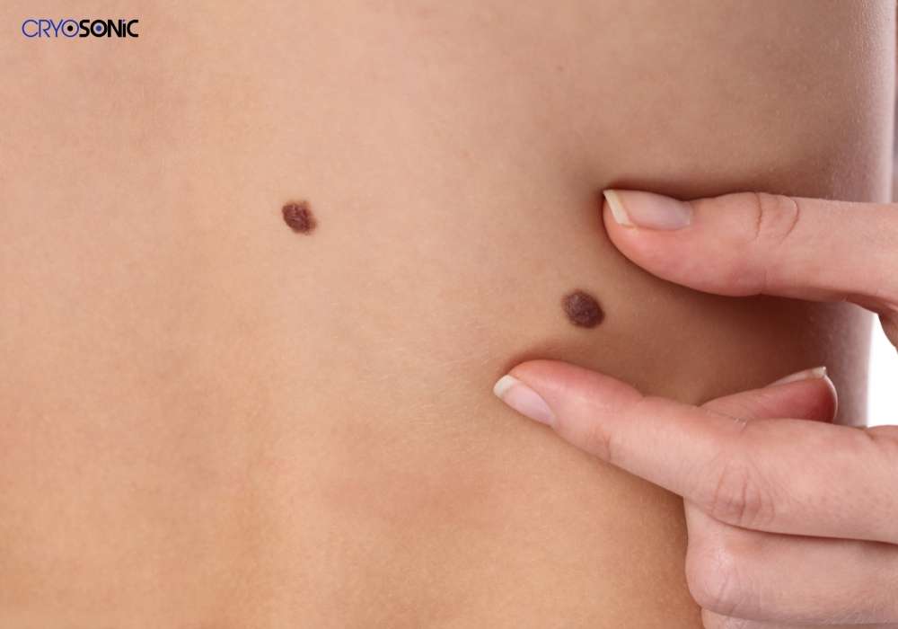Infection Risk and Poor Aftercare Peterborough