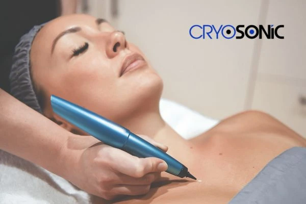 Cryosonic lesion removal prices book today! Peterborough