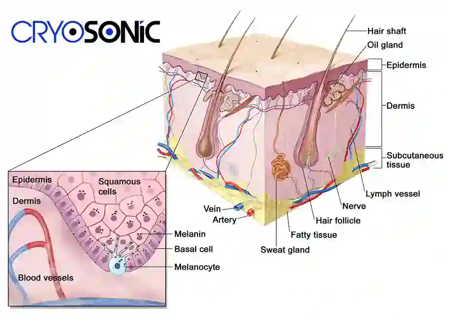 How Cryotherapy Stimulates Melanocyte Activity Peterborough